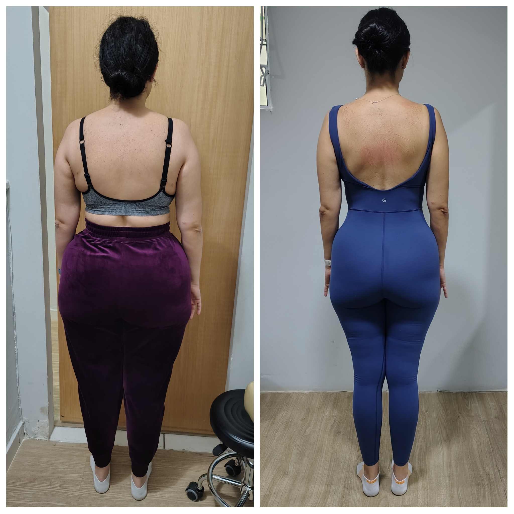 Reeducação postural