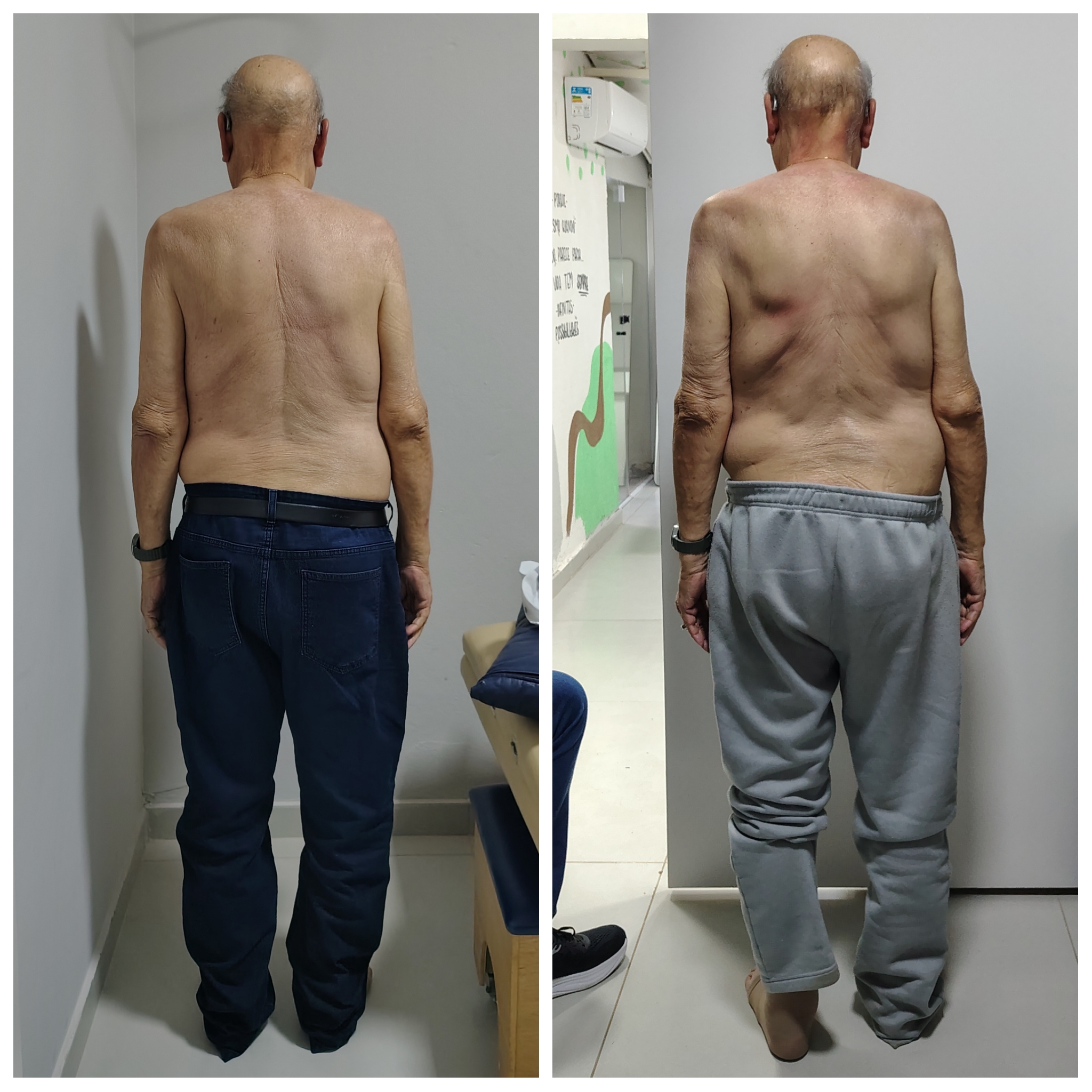 Reeducação postural